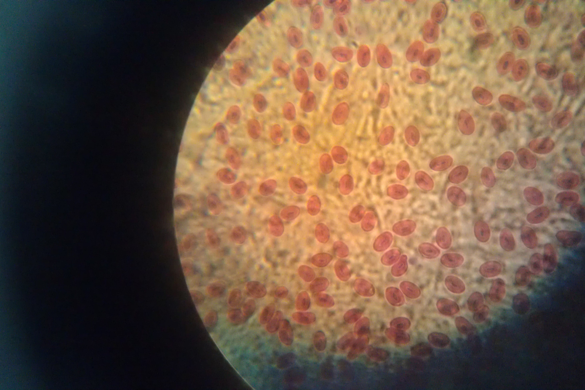 Imagen de globulos rojos en la sangre de una rana, tomada por microscopio.